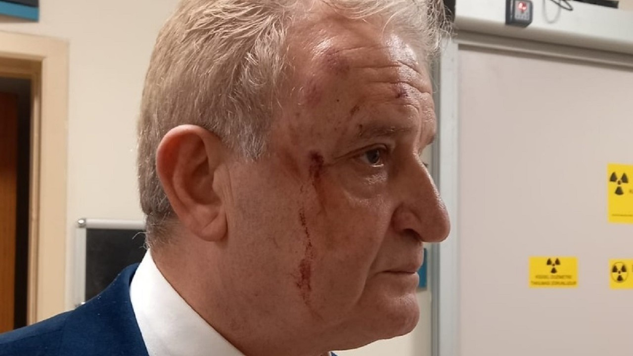 Eskişehir'de Gazetci Sağlam'a saldırı