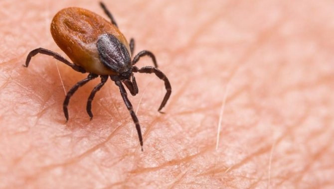 Kene Isırığı Sonrası Gelişen Et Alerjisi Genç Adamın Ölümüne Yol Açtı